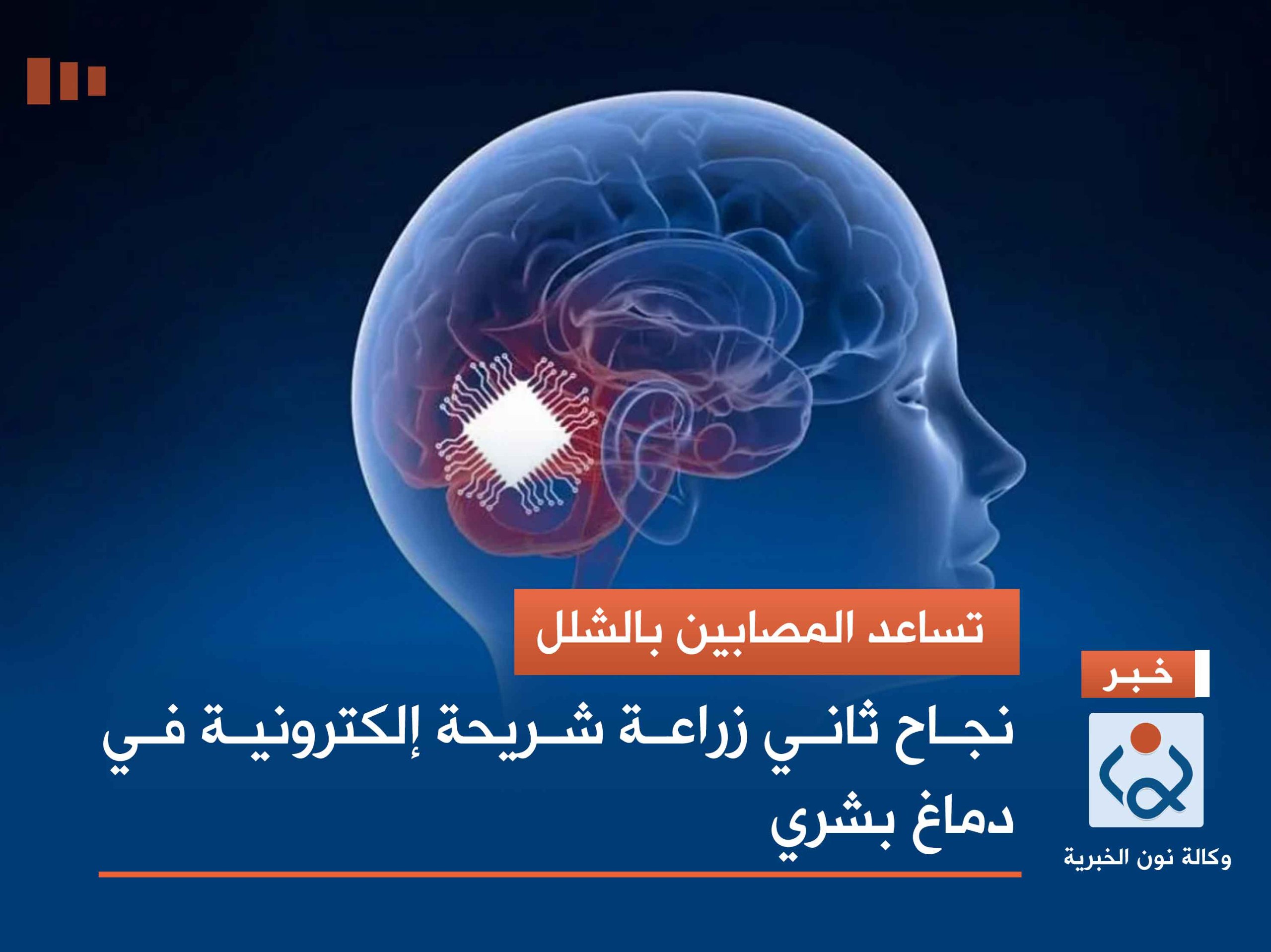 ‏ تساعد المصابين بالشلل..‏ نجاح ثاني زراعة شريحة إلكترونية في دماغ بشري