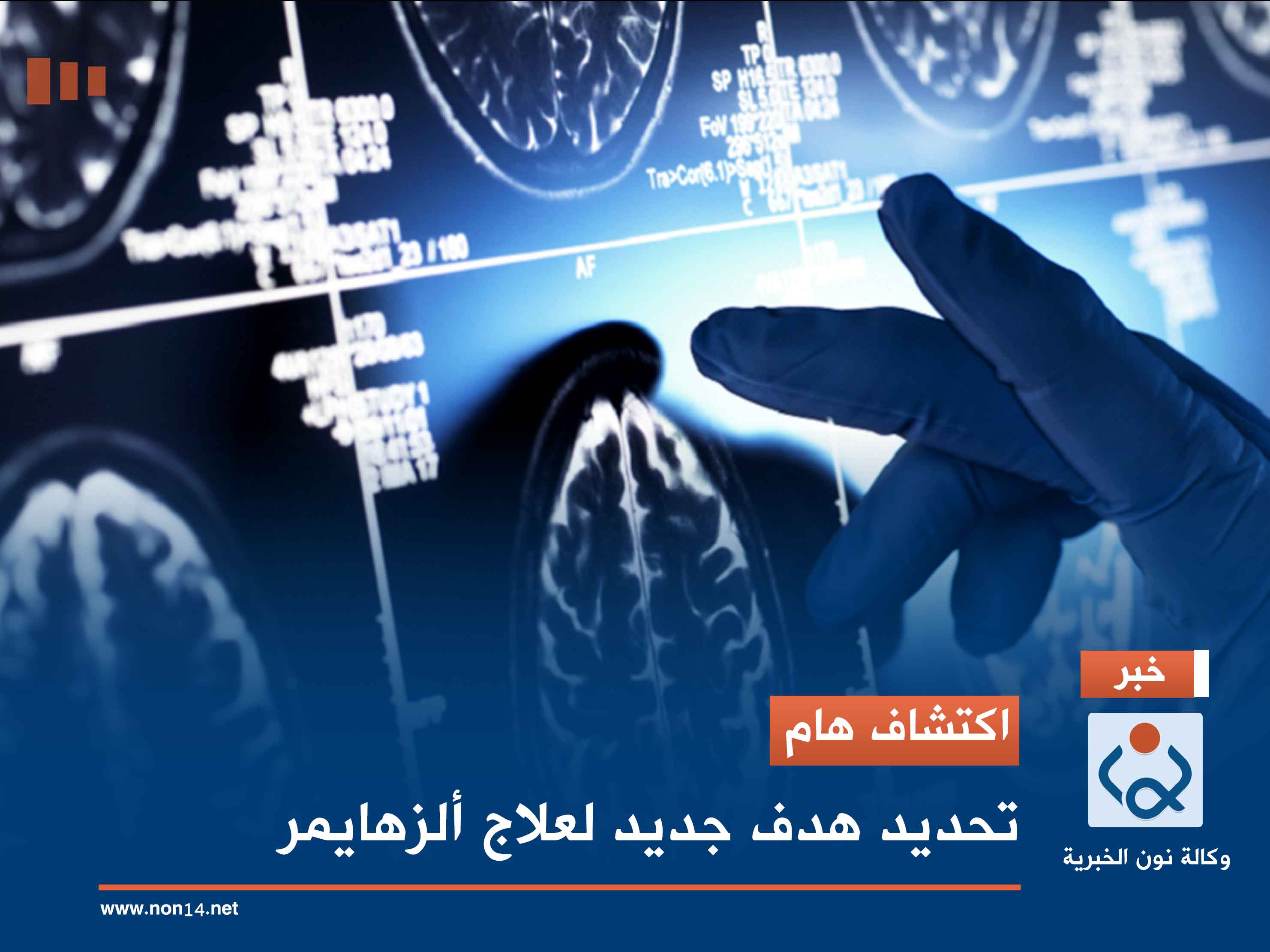 اكتشاف هام.. تحديد هدف جديد لعلاج ألزهايمر