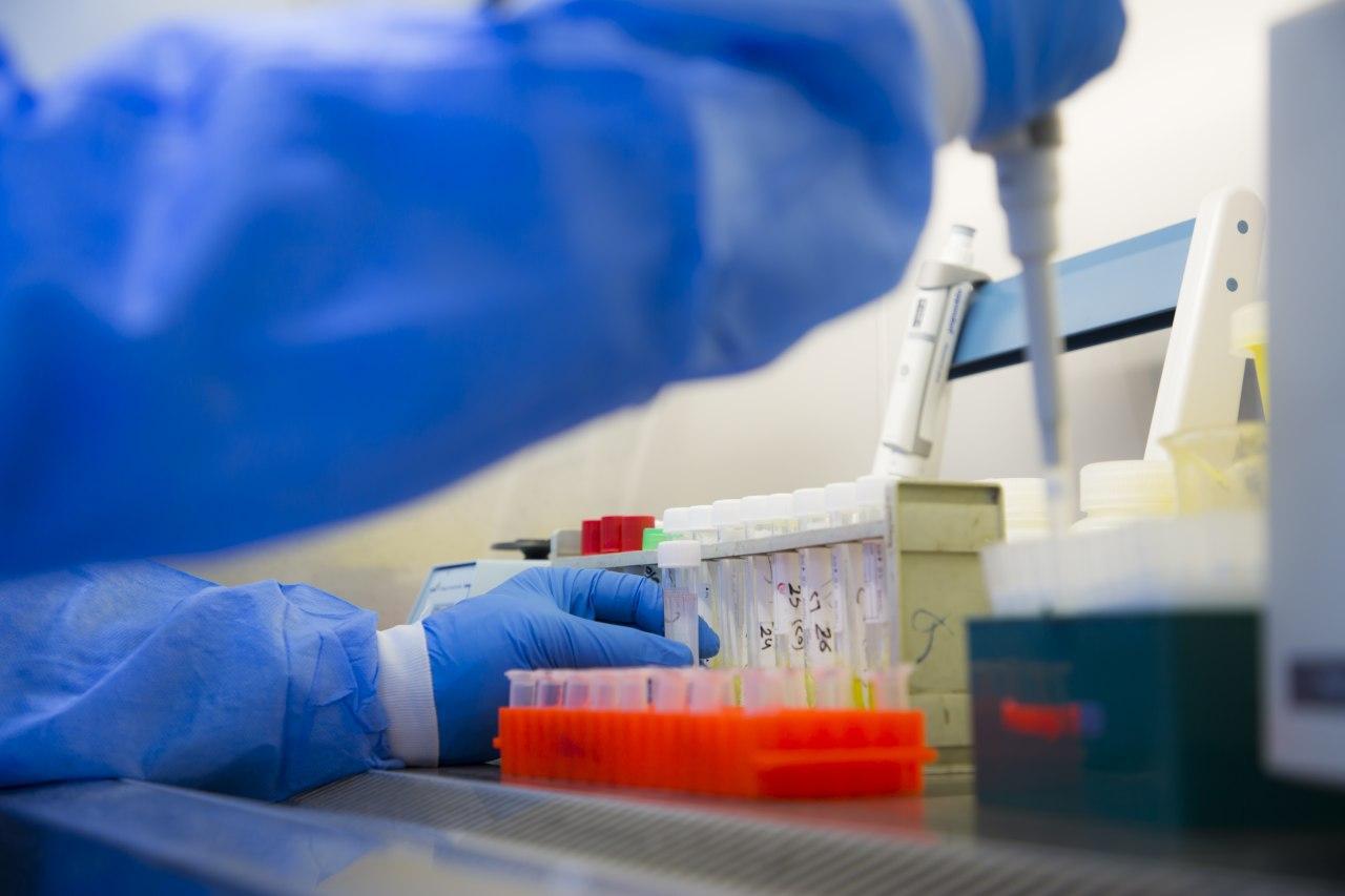 العراق .. 7 وفيات و87 اصابة بكورونا خلال 24 ساعة