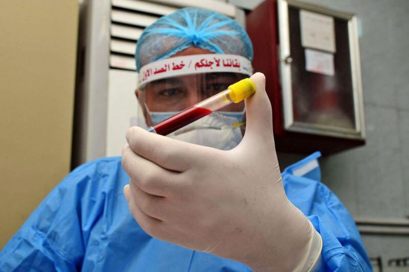 كورونا في العراق .. حالات الشفاء تتفوق على حالات الاصابة (حصيلة يومية)