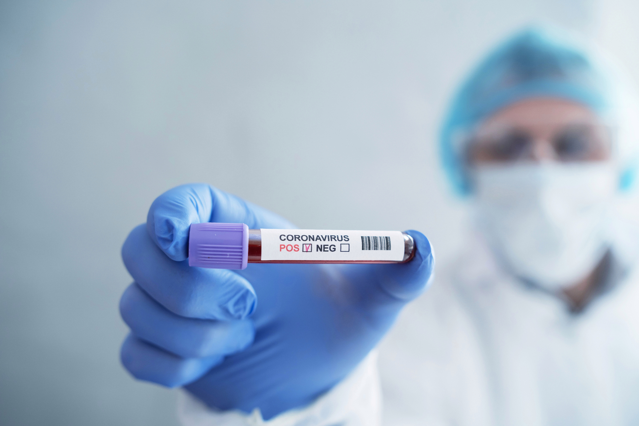 إصابات كورونا في ألمانيا تقترب من نصف مليون