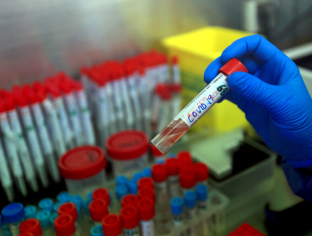 الصحة تثير قلق المواطنين بشأن أشكال كورونا المتحورة