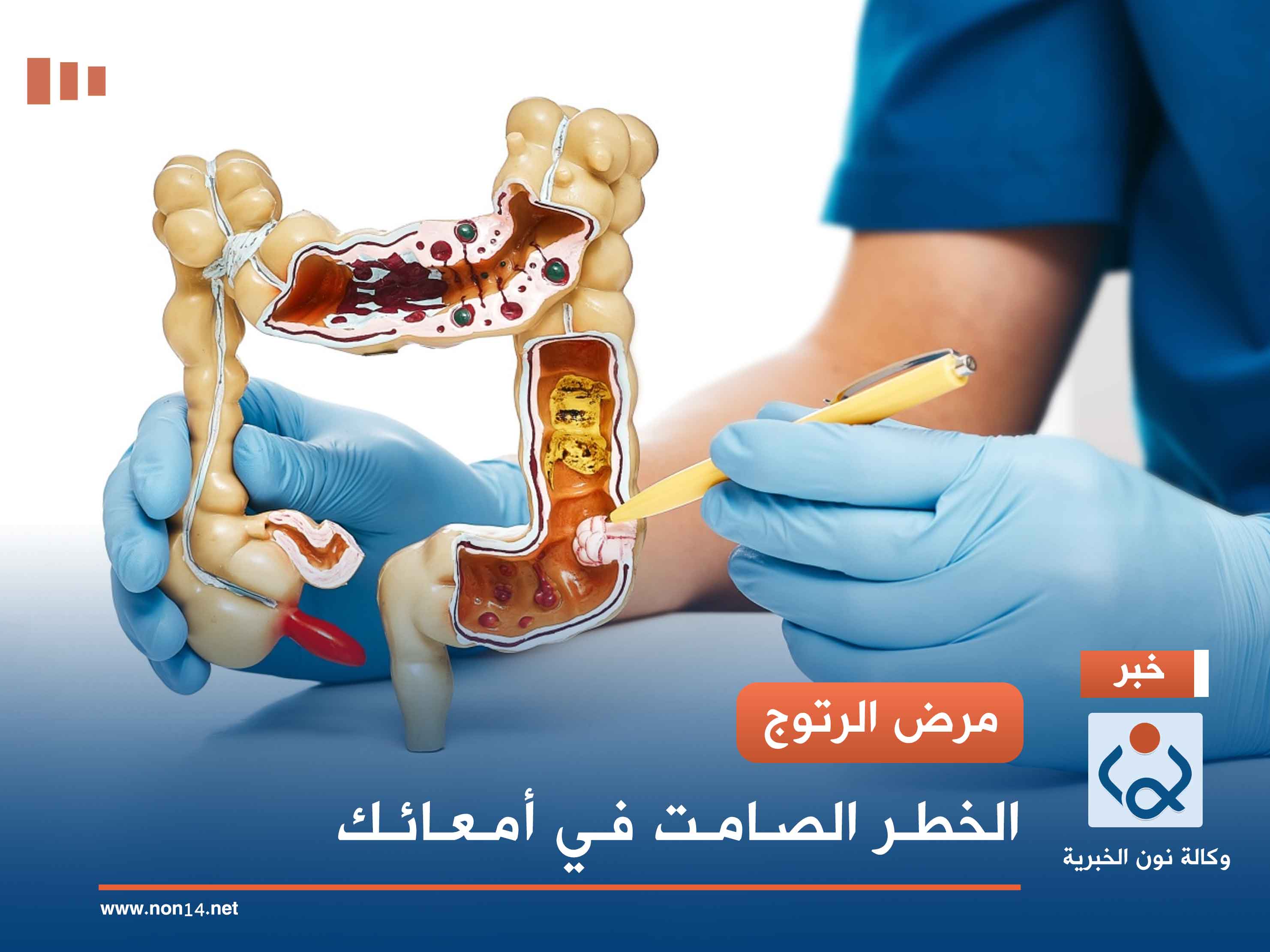 مرض الرتوج.. الخطر الصامت في أمعائك