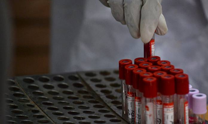 اختبار دم قد يكشف 50 نوعا من السرطان