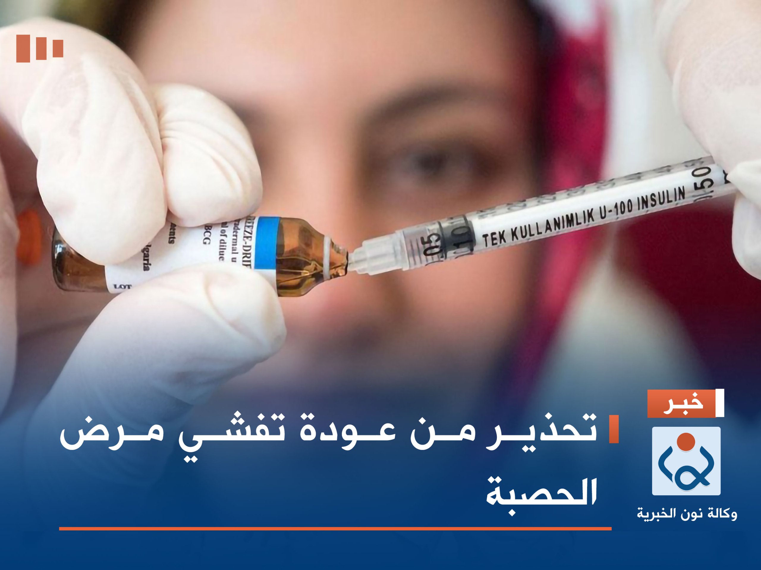 تحذير من عودة تفشي مرض الحصبة