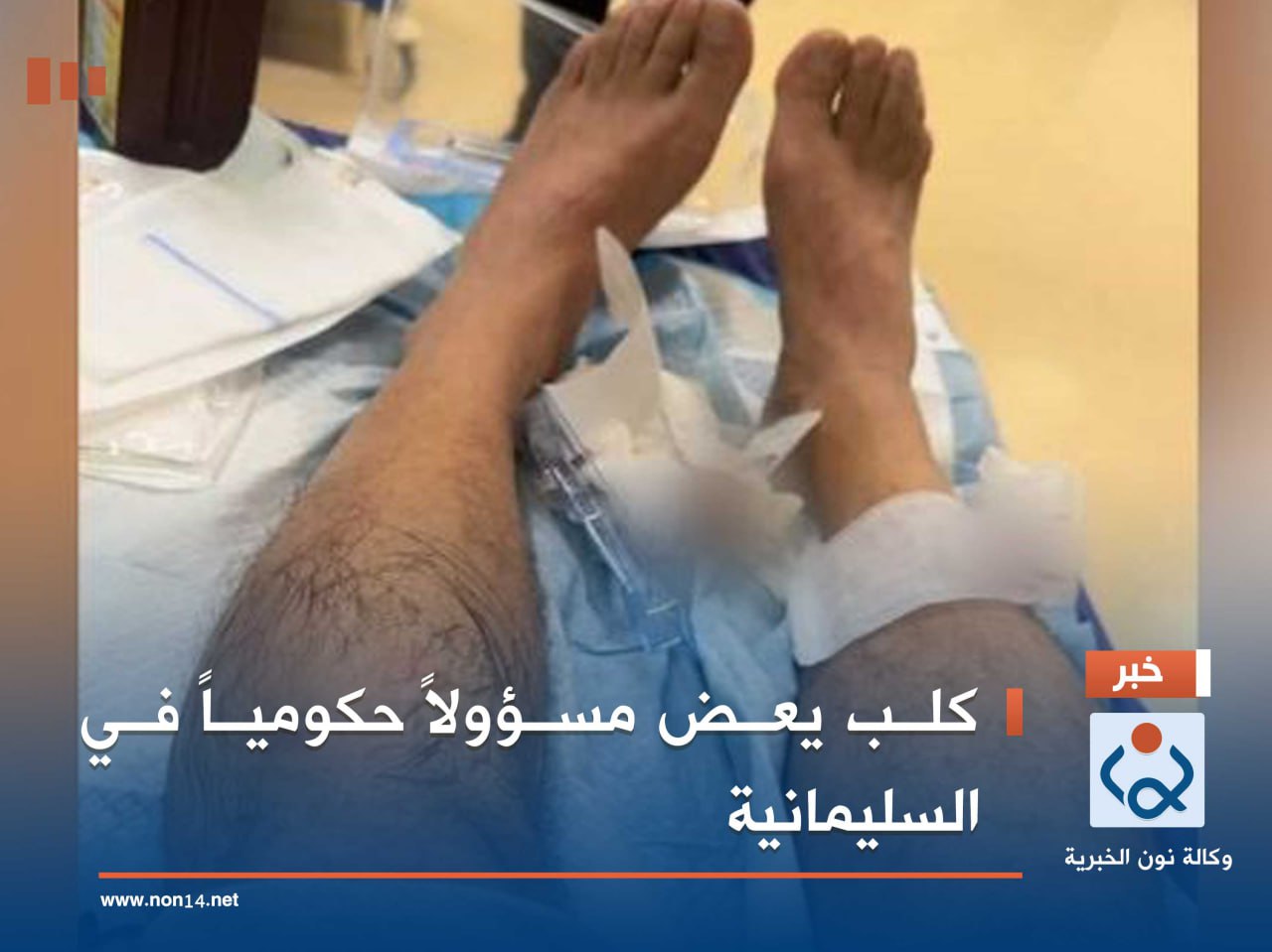 كلب يعض مسؤولاً حكومياً في السليمانية